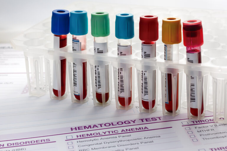 Decoding Health Indicators: The Importance of Private Blood Tests